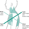 Upper crossed body